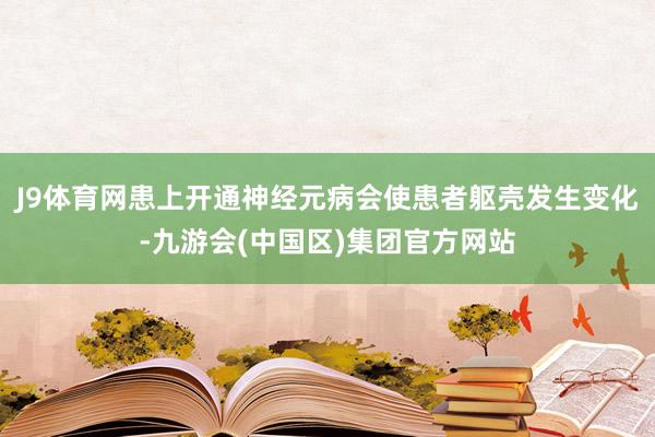 J9体育网患上开通神经元病会使患者躯壳发生变化-九游会(中国区)集团官方网站